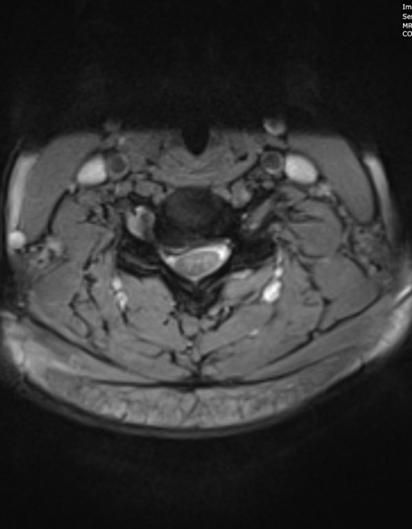 Wagonner Axial MRI photo Wagonner Axial MRI